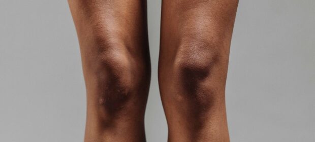 Jak wygląda artroskopia kolana?